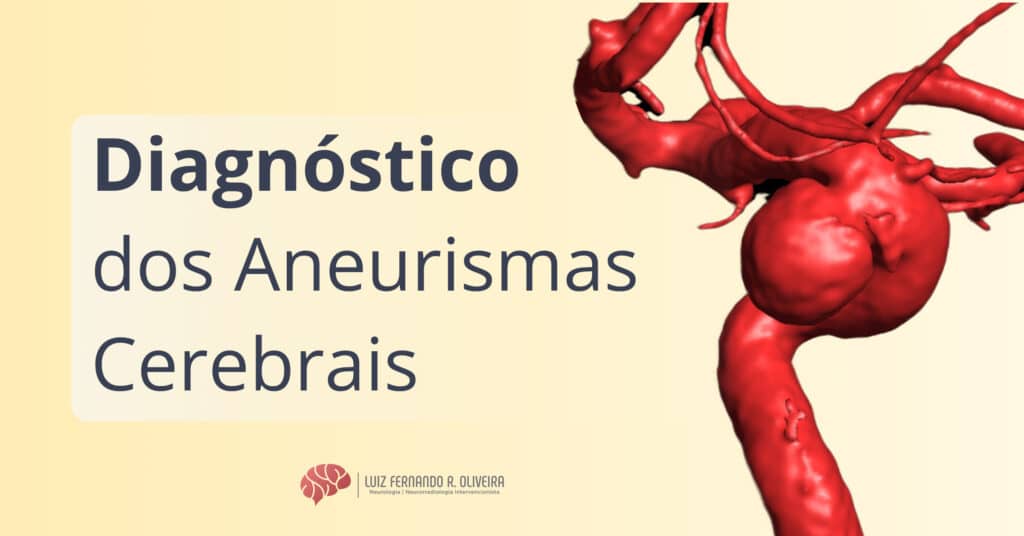 Como detectar aneurismas cerebrais