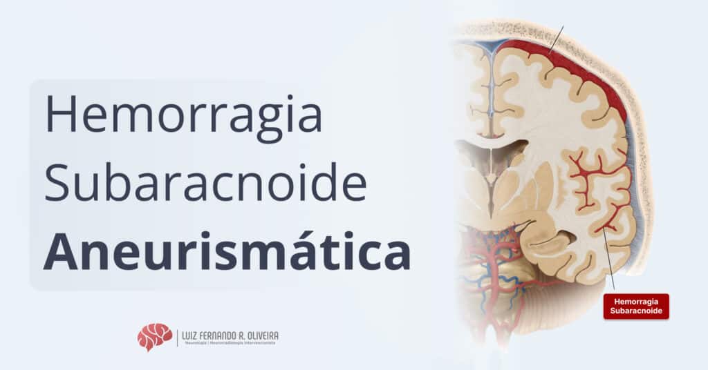 Hemorragia subaracnoide por aneurisma roto