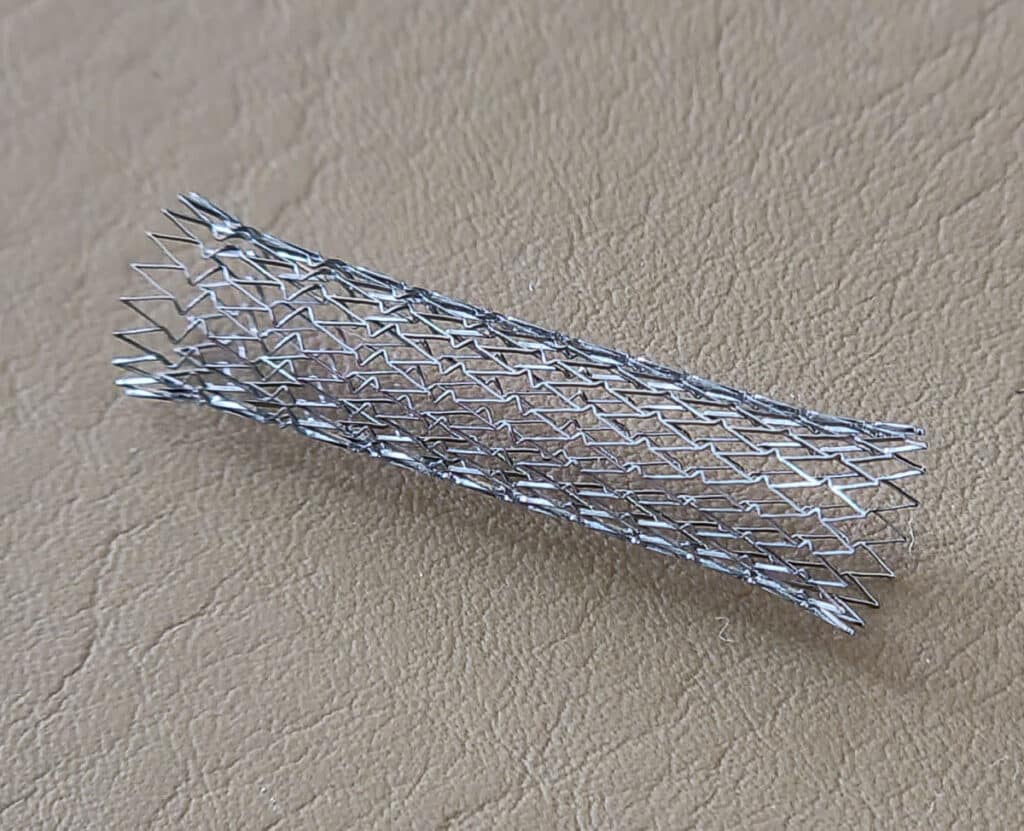 Stents são usados para tratar estenose de carótidas e prevenir AVC