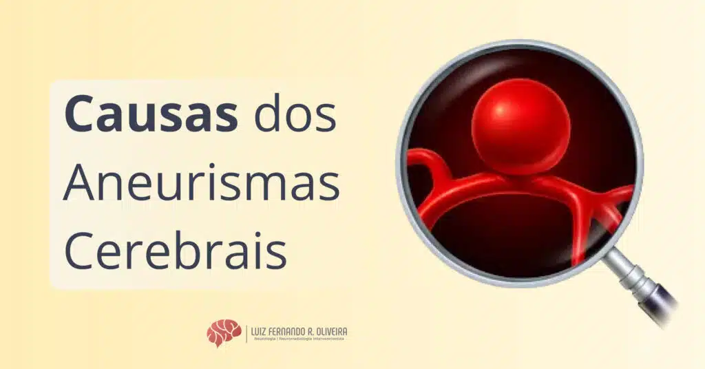 As causas dos aneurismas cerebrais são variadas