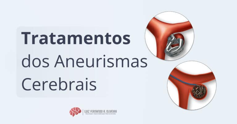 Quais os tratamentos dos aneurismas cerebrais