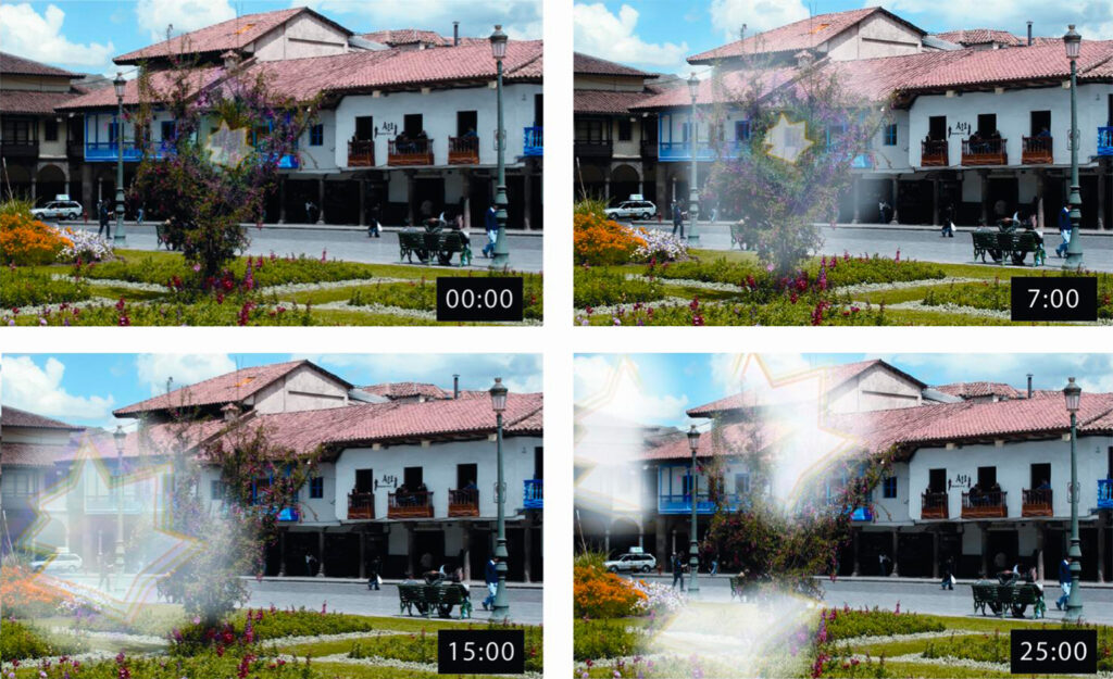 Imagem ilustrativa da aura visual da enxaqueca que começa com escotoma cintilante central, brilhante, que evoluiu para a periferia da visão.